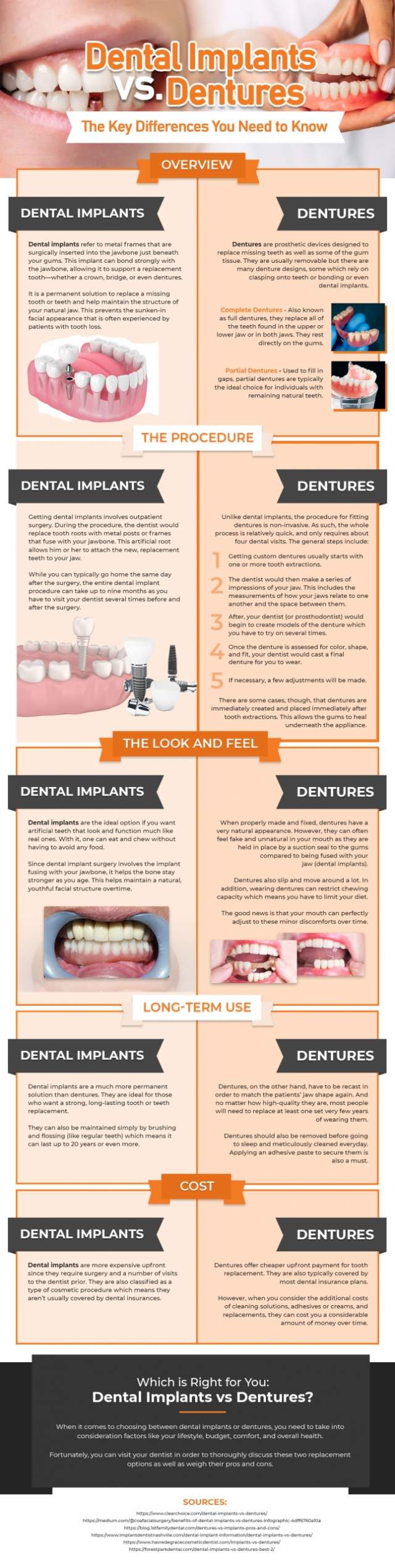 Dental-Implants-vs-Dentures